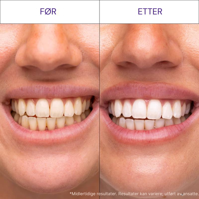 PROFESJONELLE RESULTATER