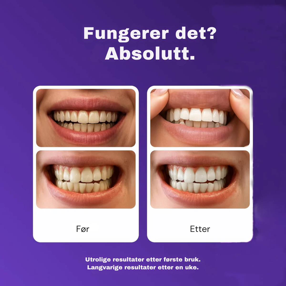 Lilla Whitening Strips